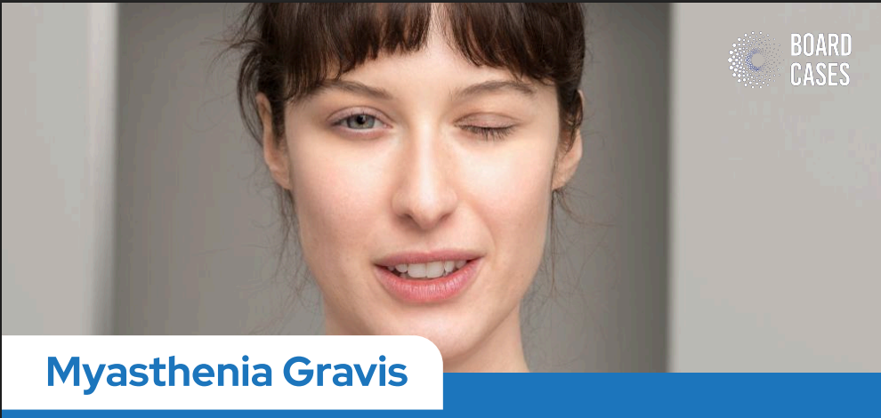 Myasthenia Gravis