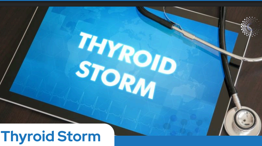Thyroid storm