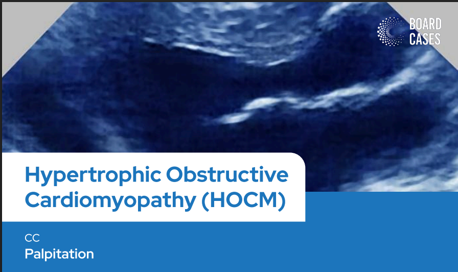Hypertrophic Obstructive  Cardiomyopathy (HOCM)