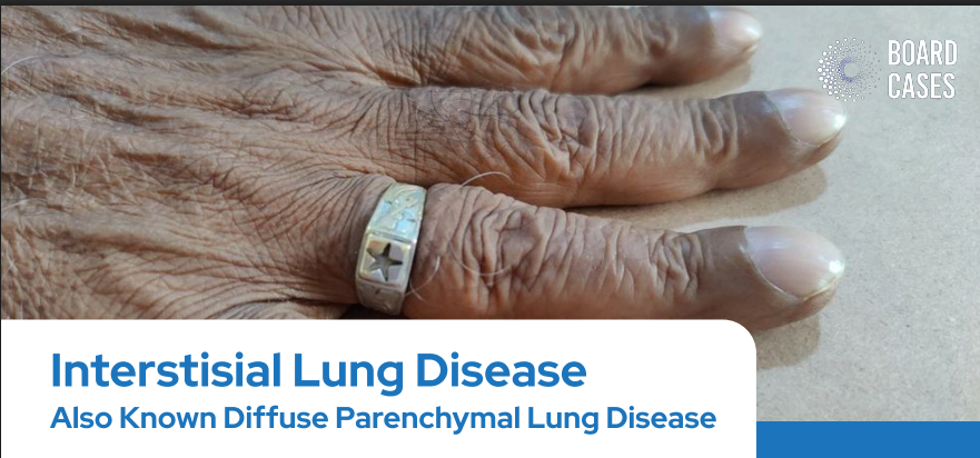 Interstisial Lung disease